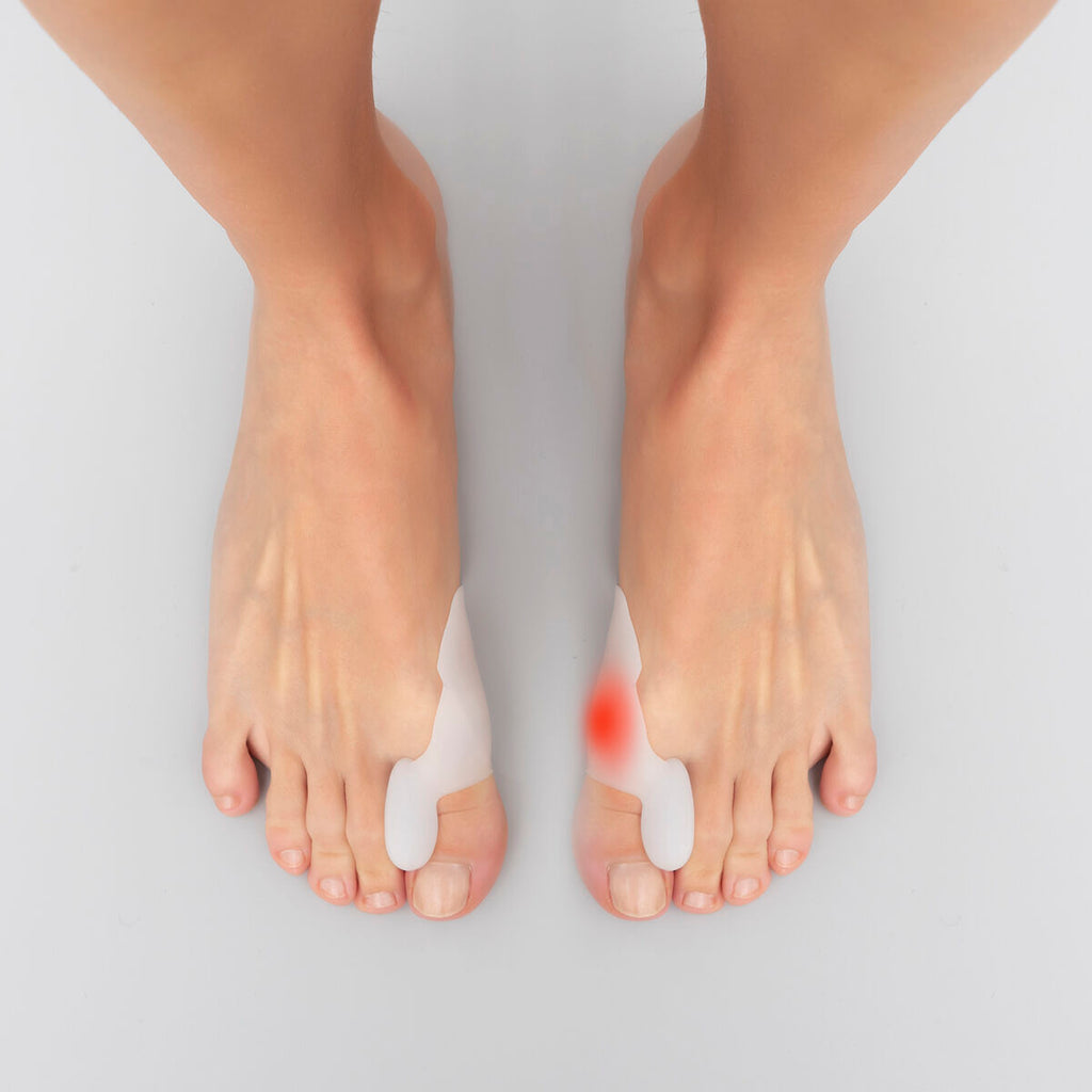 InnovaGoods Silikon-Hallux-Korrektor Bunilief – Produktansicht 1